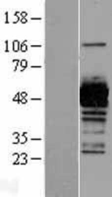 Western Blot: UAP1 Overexpression Lysate [NBL1-17493]