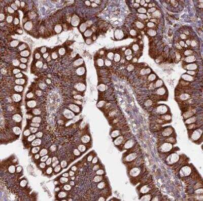 Immunohistochemistry-Paraffin: UAP1L1 Antibody [NBP1-92555]