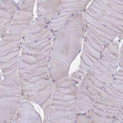 Immunohistochemistry-Paraffin: UAP1L1 Antibody [NBP1-92555]