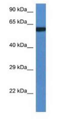 Western Blot: UAP1L1 Antibody [NBP1-74151]