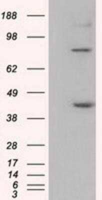 Western Blot: UAP56 Antibody (OTI2C5) [NBP2-02553]