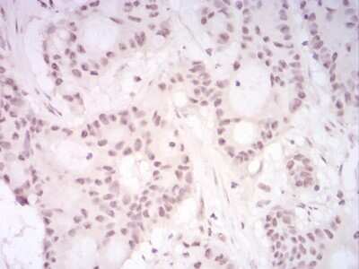 Immunohistochemistry: UAP56 Antibody (2F5G7) - BSA Free [NBP2-52455]