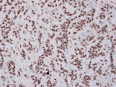Immunohistochemistry-Paraffin: UAP56 Antibody [NBP1-31356]