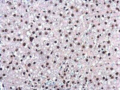Immunohistochemistry-Paraffin: UAP56 Antibody [NBP1-31356]