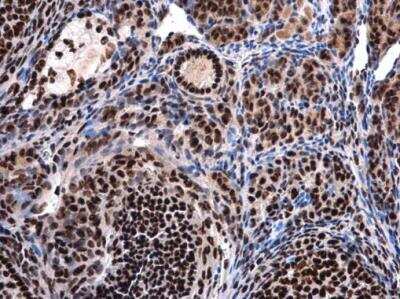 Immunohistochemistry-Paraffin: UAP56 Antibody [NBP1-31356]