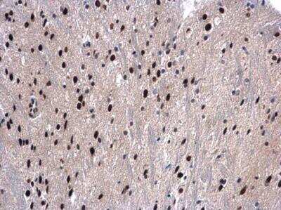 Immunohistochemistry-Paraffin: UAP56 Antibody [NBP1-31356]
