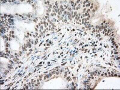 Immunohistochemistry: UAP56 Antibody (OTI2C5) - Azide and BSA Free [NBP2-74727]