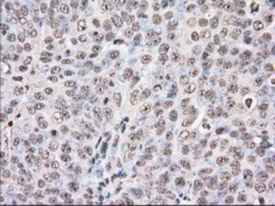 Immunohistochemistry: UAP56 Antibody (OTI2C5) - Azide and BSA Free [NBP2-74727]