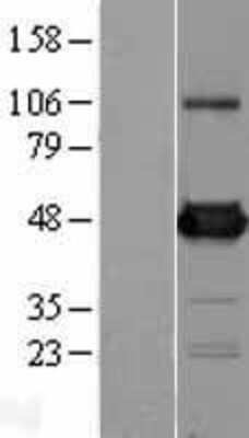 Western Blot: UAP56 Overexpression Lysate [NBL1-07916]