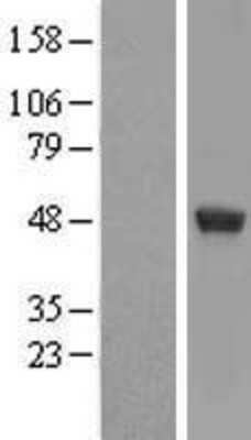 Western Blot: UAP56 Overexpression Lysate [NBL1-07917]