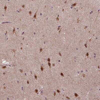 Immunohistochemistry-Paraffin: UBA3 Antibody [NBP1-83150]