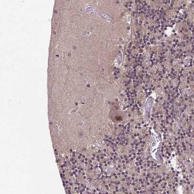 Immunohistochemistry-Paraffin: UBA3 Antibody [NBP2-48628]