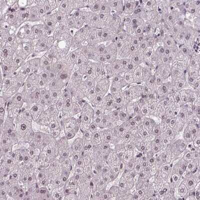 Immunohistochemistry-Paraffin: UBA3 Antibody [NBP2-48628]