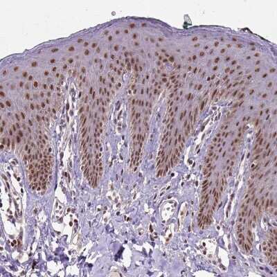 Immunohistochemistry-Paraffin: UBA3 Antibody [NBP2-48628]