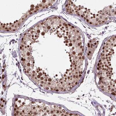 Immunohistochemistry-Paraffin: UBA3 Antibody [NBP2-48628]