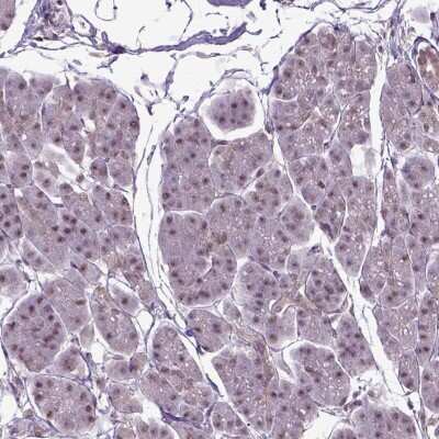 Immunohistochemistry-Paraffin: UBA3 Antibody [NBP2-49443]