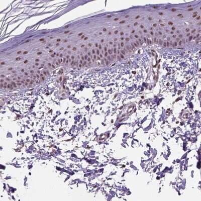 Immunohistochemistry-Paraffin: UBA3 Antibody [NBP2-49443]