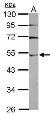 Western Blot: UBA3 Antibody [NBP2-20777]