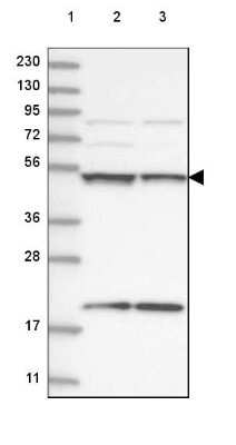 Western Blot: UBA3 Antibody [NBP2-48628]