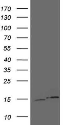 Western Blot: UBA52 Antibody (OTI4E1) [NBP2-46260]