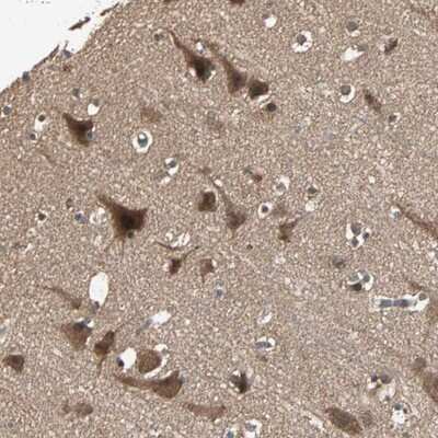 Immunohistochemistry-Paraffin: UBAC1 Antibody [NBP1-81842]