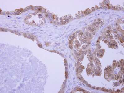 Immunohistochemistry-Paraffin: UBAC1 Antibody [NBP2-15153]