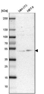 Western Blot: UBAC1 Antibody [NBP1-81842]