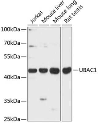 Western Blot: UBAC1 AntibodyAzide and BSA Free [NBP2-94250]