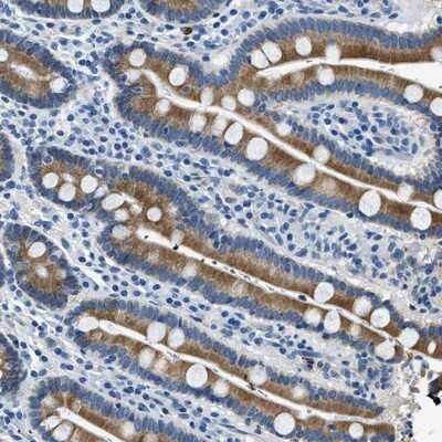Immunohistochemistry-Paraffin: UBAC2 Antibody [NBP1-93893]