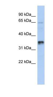 Western Blot: UBAC2 Antibody [NBP1-91463]