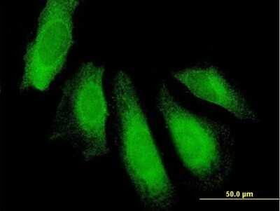 Immunocytochemistry/ Immunofluorescence: UBAP1 Antibody [H00051271-B01P]