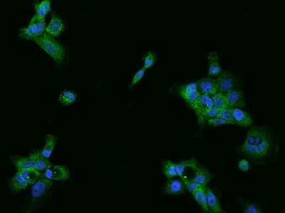 Immunocytochemistry/ Immunofluorescence: UBAP1 Antibody [NBP2-98559]