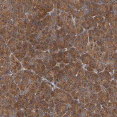 Immunohistochemistry-Paraffin: UBAP1 Antibody [NBP1-80651]