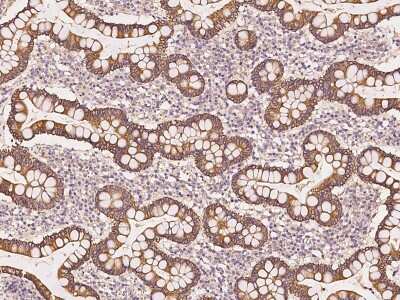 Immunohistochemistry-Paraffin: UBAP1 Antibody [NBP2-98559]