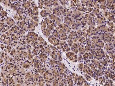 Immunohistochemistry-Paraffin: UBAP1 Antibody [NBP2-98559]