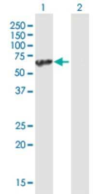 Western Blot: UBAP1 Antibody [H00051271-B01P]