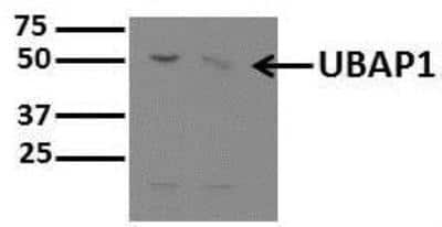 Western Blot: UBAP1 Antibody [NBP1-80651]