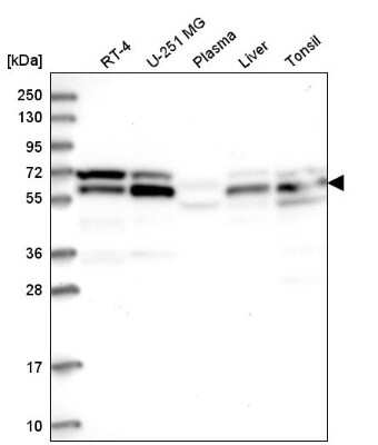 Western Blot: UBAP1 Antibody [NBP2-58969]