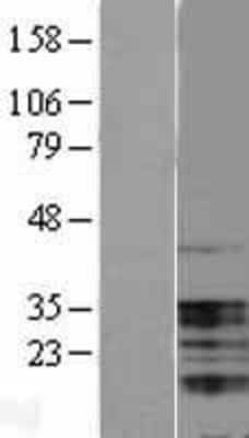 Western Blot: UBAP1 Overexpression Lysate [NBL1-17504]