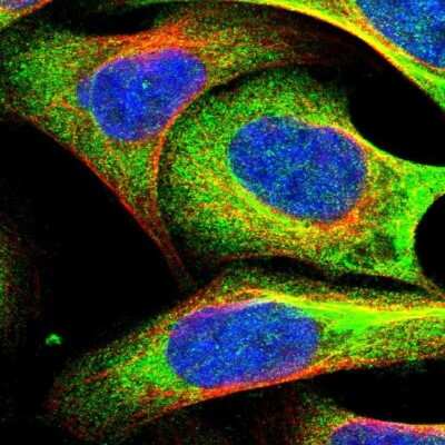 Immunocytochemistry/ Immunofluorescence: UBAP2 Antibody [NBP1-90829]