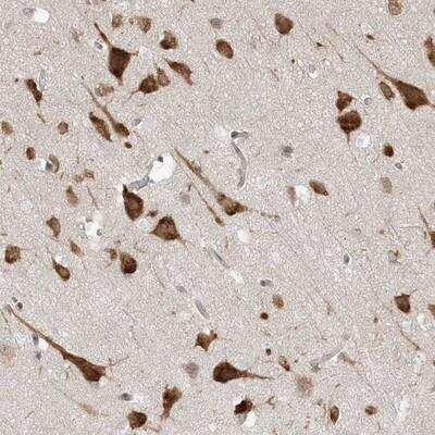 Immunohistochemistry-Paraffin: UBAP2L Antibody [NBP1-83034]