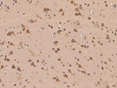 Immunohistochemistry-Paraffin: UBAP2L Antibody [NBP2-97847]