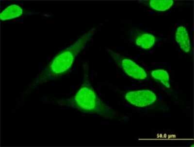 Immunocytochemistry/ Immunofluorescence: UBASH3B/STS1/Tula-2 Antibody (3G7) [H00084959-M01]