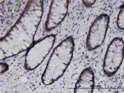 Immunohistochemistry-Paraffin: UBASH3B/STS1/Tula-2 Antibody (3G7) [H00084959-M01]