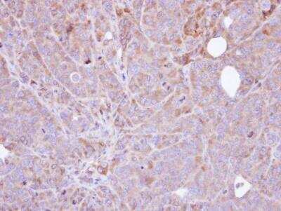 Immunohistochemistry-Paraffin: UBASH3B/STS1/Tula-2 Antibody [NBP1-32592]