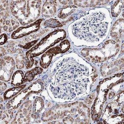 Immunohistochemistry-Paraffin: UBASH3B/STS1/Tula-2 Antibody [NBP1-92456]