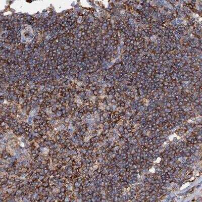 Immunohistochemistry-Paraffin: UBASH3B/STS1/Tula-2 Antibody [NBP2-34053]