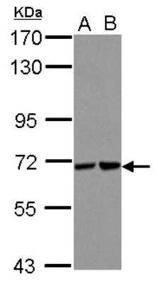 Western Blot: UBASH3B/STS1/Tula-2 Antibody [NBP2-20524]