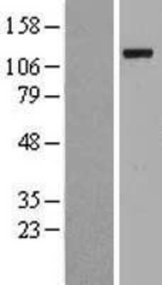 Western Blot: Ubiquitin-activating Enzyme/UBE1 Overexpression Lysate [NBL1-17495]