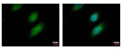 Immunocytochemistry/ Immunofluorescence: HR6A/UBE2A Antibody [NBP2-20780]